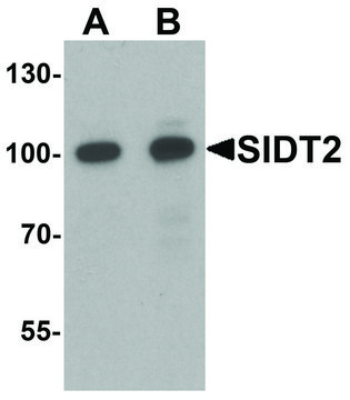 Anti-SIDT2 antibody produced in rabbit affinity isolated antibody, buffered aqueous solution