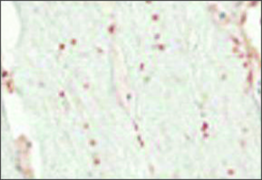 Anti-OLIG2 (AB2) antibody produced in rabbit affinity isolated antibody