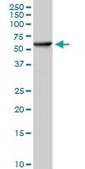 Anti-HSPD1 antibody produced in rabbit purified immunoglobulin, buffered aqueous solution