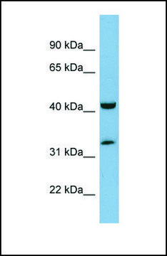 Anti-RAGE, (N-terminal) antibody produced in rabbit affinity isolated antibody