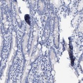 Anti-KRT14 antibody produced in rabbit Prestige Antibodies&#174; Powered by Atlas Antibodies, affinity isolated antibody, buffered aqueous glycerol solution