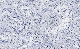 Anti-G3BP1 Antibody, clone 1B10 ZooMAb&#174; Rabbit Monoclonal recombinant, expressed in HEK 293 cells