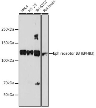 Anti-Eph receptor B3 (EPHB3) Antibody, clone 8H9P4, Rabbit Monoclonal
