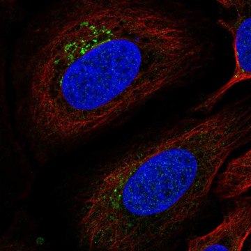 Anti-ITM2B antibody produced in rabbit Prestige Antibodies&#174; Powered by Atlas Antibodies, affinity isolated antibody