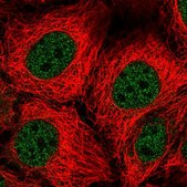 Anti-SLC15A1 antibody produced in rabbit Prestige Antibodies&#174; Powered by Atlas Antibodies, affinity isolated antibody, buffered aqueous glycerol solution