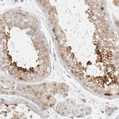 Anti-EIF4G1 antibody produced in rabbit Prestige Antibodies&#174; Powered by Atlas Antibodies, affinity isolated antibody, buffered aqueous glycerol solution