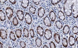 Anti-Vitamin D3 Receptor Antibody, clone 1M19 ZooMAb&#174; Rabbit Monoclonal recombinant, expressed in HEK 293 cells