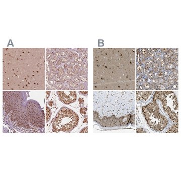 Anti-PSMC5 antibody produced in rabbit Prestige Antibodies&#174; Powered by Atlas Antibodies, affinity isolated antibody