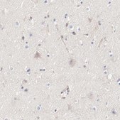 Anti-ARHGEF6 antibody produced in rabbit Prestige Antibodies&#174; Powered by Atlas Antibodies, affinity isolated antibody, buffered aqueous glycerol solution