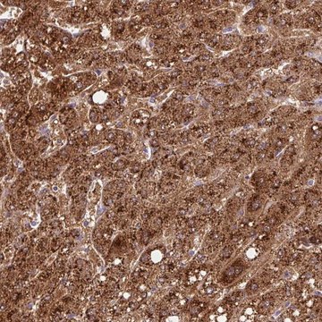 Anti-TONSL antibody produced in rabbit Prestige Antibodies&#174; Powered by Atlas Antibodies, affinity isolated antibody, buffered aqueous glycerol solution