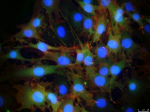 OP9-DL1 hDL-1-Expressing mOP9 Cell Line