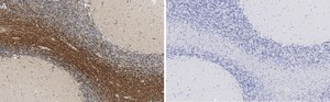 Anti-Bin1 Antibody, clone 99D.2 ZooMAb&#174; Mouse Monoclonal recombinant, expressed in HEK 293 cells