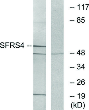 Anti-SFRS4 antibody produced in rabbit affinity isolated antibody