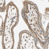 Anti-IKBKG antibody produced in rabbit Prestige Antibodies&#174; Powered by Atlas Antibodies, affinity isolated antibody, buffered aqueous glycerol solution
