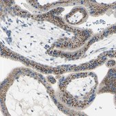 Anti-B4GALT1 antibody produced in rabbit Ab1, Prestige Antibodies&#174; Powered by Atlas Antibodies, affinity isolated antibody, buffered aqueous glycerol solution