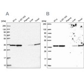 Anti-ANXA2 Prestige Antibodies&#174; Powered by Atlas Antibodies, affinity isolated antibody