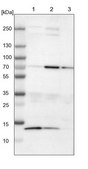 Anti-BIRC2 antibody produced in rabbit Prestige Antibodies&#174; Powered by Atlas Antibodies, affinity isolated antibody, buffered aqueous glycerol solution