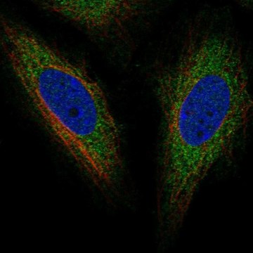 Anti-TOR1AIP2 antibody produced in rabbit Prestige Antibodies&#174; Powered by Atlas Antibodies, affinity isolated antibody