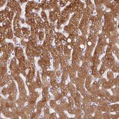 Anti-HSD11B1 antibody produced in rabbit Prestige Antibodies&#174; Powered by Atlas Antibodies, affinity isolated antibody, buffered aqueous glycerol solution