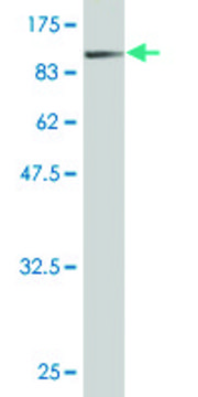 Monoclonal Anti-BFSP1 antibody produced in mouse clone 1B11, purified immunoglobulin, buffered aqueous solution