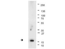 Anti-trimethyl-Histone H3 (Lys4) Antibody, clone 15-10C-E4, rabbit monoclonal clone 15-10C-E4, Upstate&#174;, from rabbit