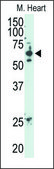 Anti-SENP2 (C-term) antibody produced in rabbit IgG fraction of antiserum, buffered aqueous solution