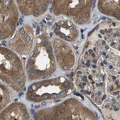 Anti-ARFGAP2 antibody produced in rabbit Prestige Antibodies&#174; Powered by Atlas Antibodies, affinity isolated antibody, buffered aqueous glycerol solution