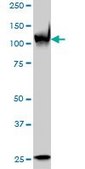 Monoclonal Anti-PARP1 antibody produced in mouse clone 3G4, purified immunoglobulin, buffered aqueous solution
