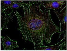 Monoclonal Anti-FYN antibody produced in mouse clone FYN-01