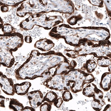 Anti-IGF2BP3 antibody produced in rabbit Prestige Antibodies&#174; Powered by Atlas Antibodies, affinity isolated antibody, buffered aqueous glycerol solution