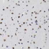 Anti-Phospho-Smad3-S423/S425 antibody produced in rabbit