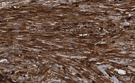 Anti-&#946;-Actin Antibody, clone 6L12, ZooMAb&#174; Rabbit Monoclonal recombinant, expressed in HEK 293 cells