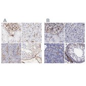 Anti-FLNA antibody produced in rabbit Ab3, Prestige Antibodies&#174; Powered by Atlas Antibodies, affinity isolated antibody, buffered aqueous glycerol solution