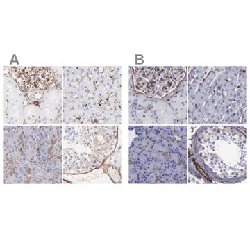 Anti-FLNA antibody produced in rabbit Ab3, Prestige Antibodies® Powered by Atlas Antibodies, affinity isolated antibody, buffered aqueous glycerol solution