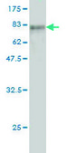 Monoclonal Anti-TUBA6 antibody produced in mouse clone S11, purified immunoglobulin, buffered aqueous solution