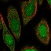 Anti-UPF3B antibody produced in rabbit Prestige Antibodies&#174; Powered by Atlas Antibodies, affinity isolated antibody