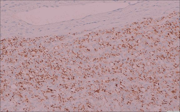 Prostein (EP381) Rabbit Monoclonal Primary Antibody