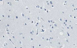 Anti-NOVA2 Antibody, clone 2J16 ZooMAb&#174; Rabbit Monoclonal recombinant, expressed in HEK 293 cells
