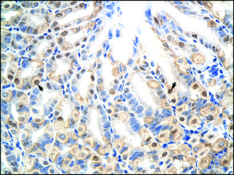 Anti-E2F7 antibody produced in rabbit affinity isolated antibody