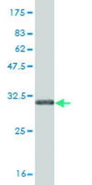 Monoclonal Anti-SLC5A2 antibody produced in mouse clone 3G8, purified immunoglobulin, buffered aqueous solution