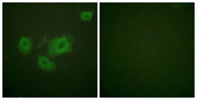 Anti-KIR6.2 (PHOSPHO-THR224) affinity isolated antibody