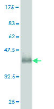 ANTI-GUCY2D antibody produced in mouse clone 5E10, purified immunoglobulin, buffered aqueous solution