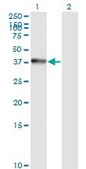 Monoclonal Anti-ANXA2, (C-terminal) antibody produced in mouse clone 1G7, purified immunoglobulin, buffered aqueous solution