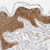 Anti-EIF4G1 antibody produced in rabbit Prestige Antibodies&#174; Powered by Atlas Antibodies, affinity isolated antibody, buffered aqueous glycerol solution