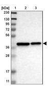 Anti-TMEM19 antibody produced in rabbit Prestige Antibodies&#174; Powered by Atlas Antibodies, affinity isolated antibody, buffered aqueous glycerol solution