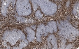 Anti-TAGLN Antibody, clone 1D10 , ZooMAb&#174; Rabbit Monoclonal recombinant, expressed in HEK 293 cells