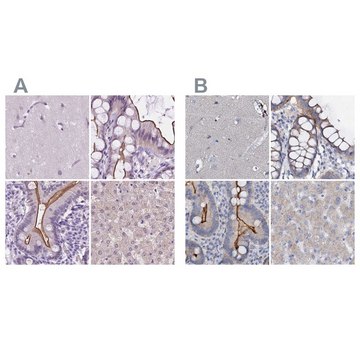 Anti-ACY3 antibody produced in rabbit Prestige Antibodies&#174; Powered by Atlas Antibodies, affinity isolated antibody, buffered aqueous glycerol solution