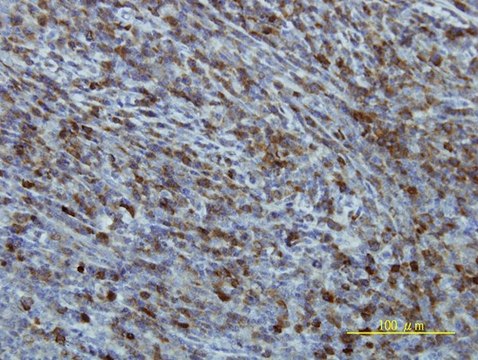 Monoclonal Anti-EIF2B2 antibody produced in mouse clone 5B12-E10, purified immunoglobulin, buffered aqueous solution