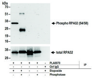 Rabbit anti-Phospho RPA32 (S4/S8) Antibody, Affinity Purified Powered by Bethyl Laboratories, Inc.