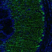 Anti-KIF5A antibody produced in rabbit Prestige Antibodies&#174; Powered by Atlas Antibodies, affinity isolated antibody, buffered aqueous glycerol solution